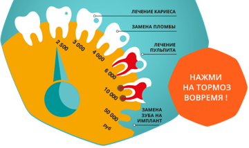 для лечение зубов